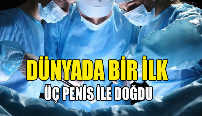 3 penisle dogdu giynik gazetesi